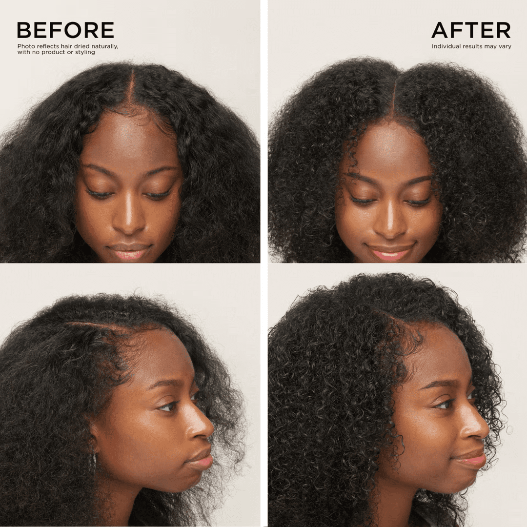 Dr Groot Hair Growth - Before After Results