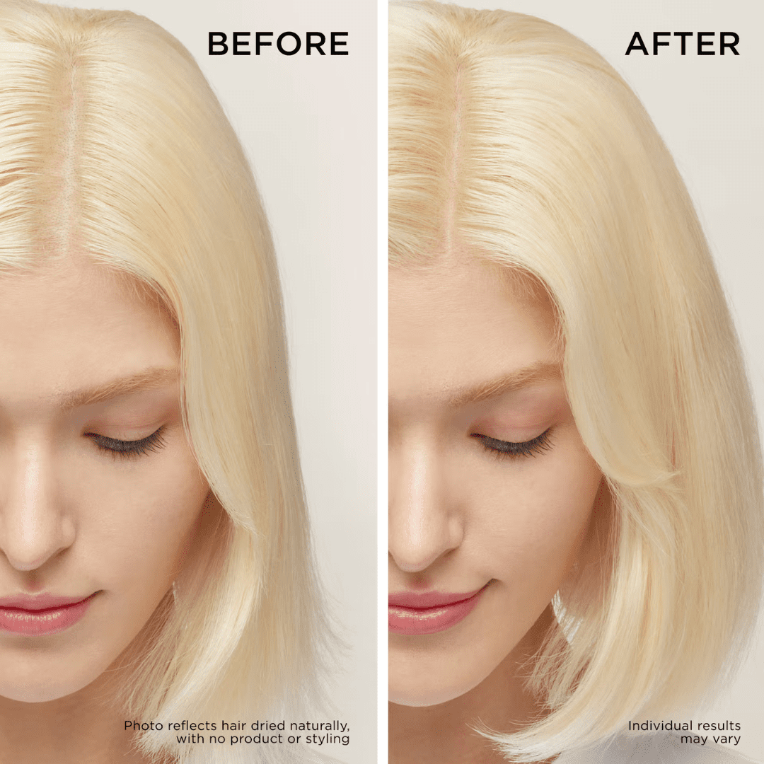 Dr Groot Hair Thickening - Before and After Results